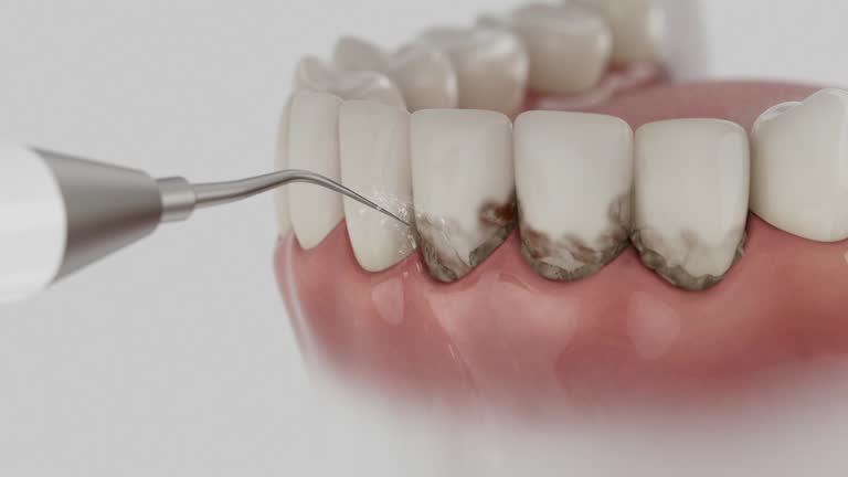 Trusted Tooth Extraction service in Pittsville, MD - Dentist Open Now